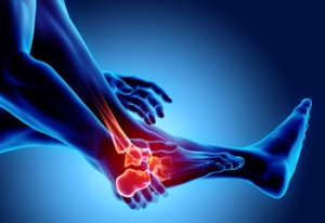 Risk Factors and Causes of Foot Stress Fractures
